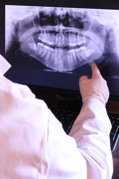 Best Emergency Treatment for Oral Infections in Eureka, MT